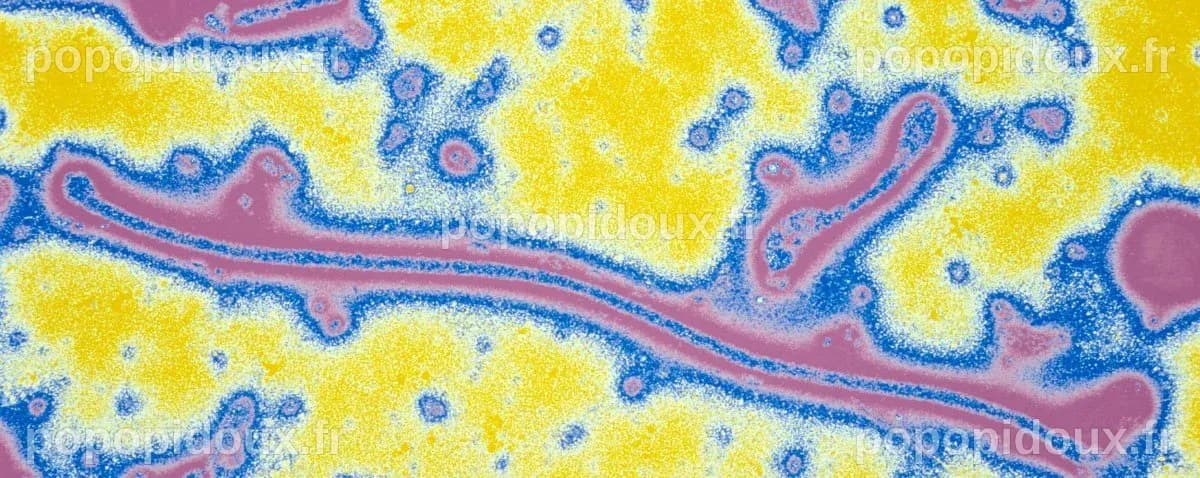 Ebola : symptômes, traitement, prévention - Institut Pasteur