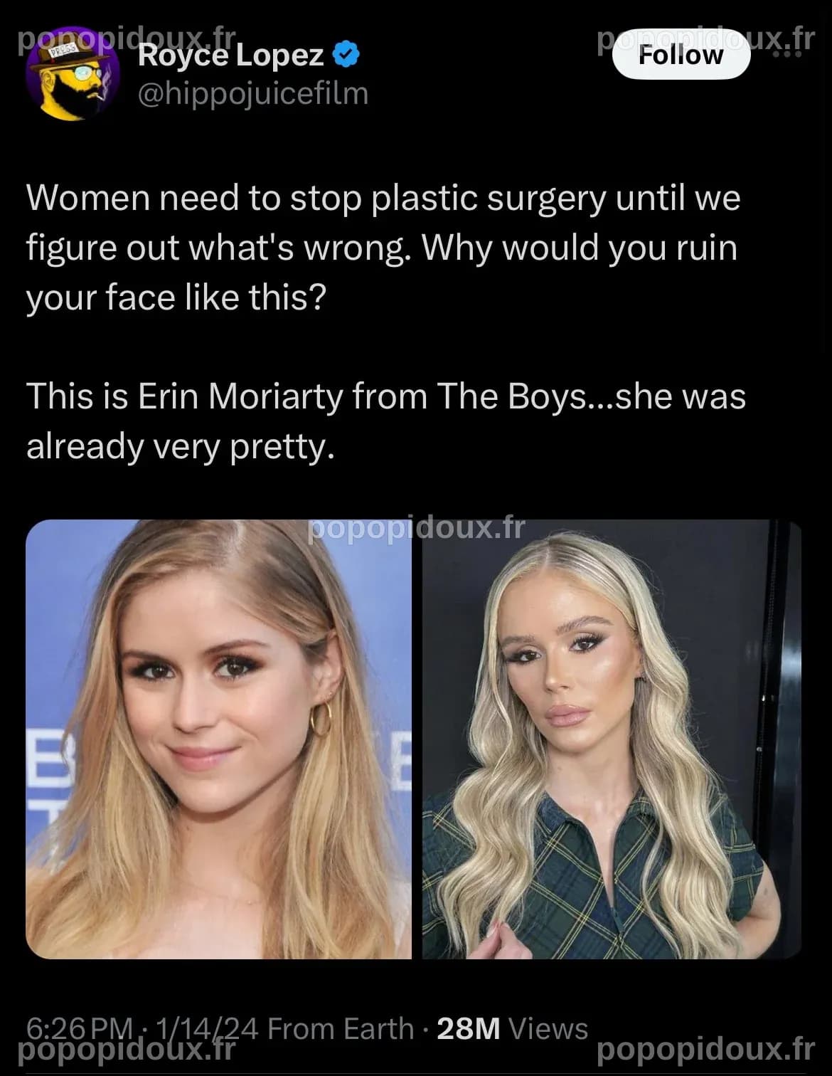 Erin Moriarty Plastic Surgery: Image Gallery | Know Your Meme