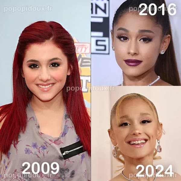 Ariana Grande Chirurgie Esthétique