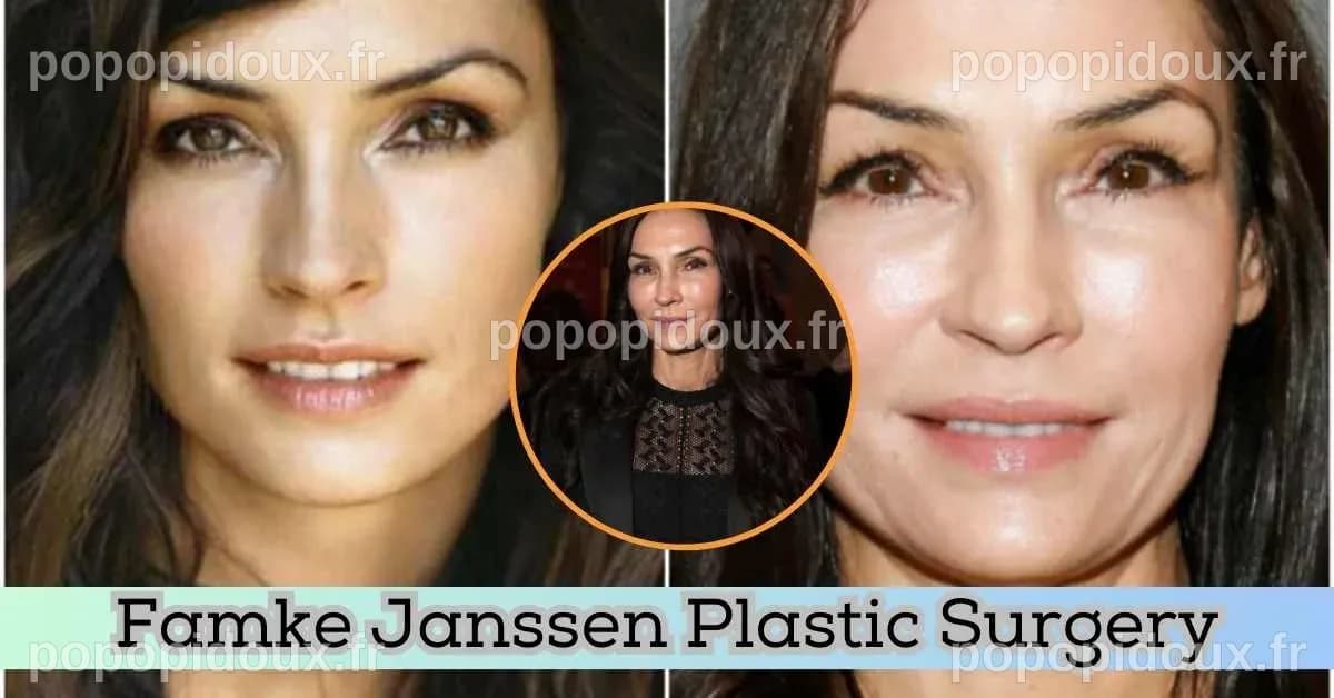 Famke Janssen Plastic Surgery: A Look At Her Transformation After And ...