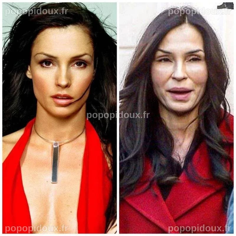 Famke Janssen et la Chirurgie Esthétique : Une Analyse Complète