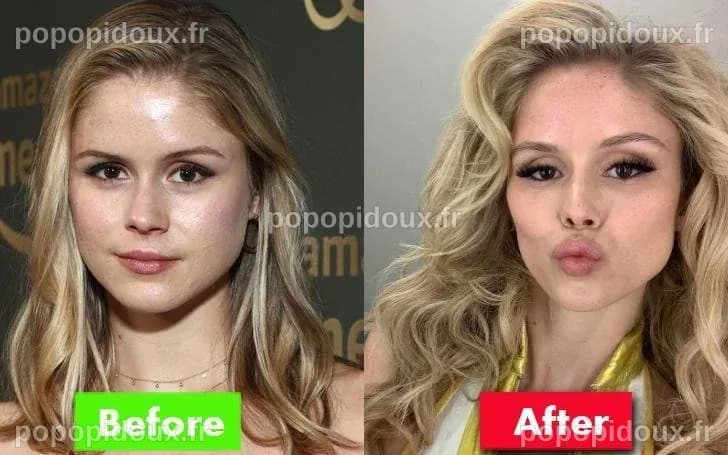 Erin Moriarty Chirurgie : "Erin Moriarty : Rumeurs et Vérités sur sa ...