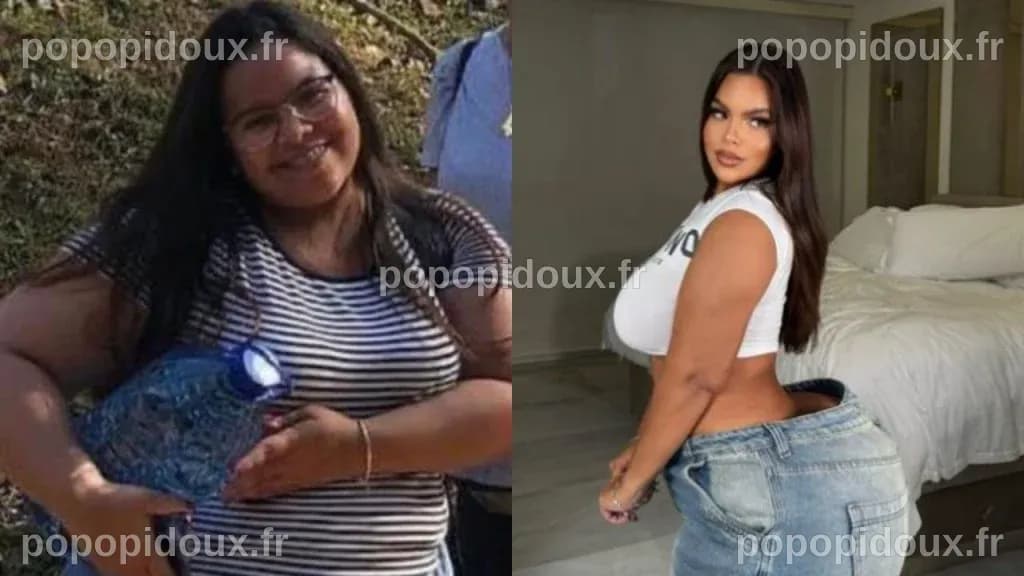 La Transformation de Gracie Bon : Un Voyage à Travers la Chirurgie Esthétique