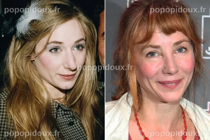 Ces stars Françaises ont toutes eu recours à la chirurgie esthétique et ...