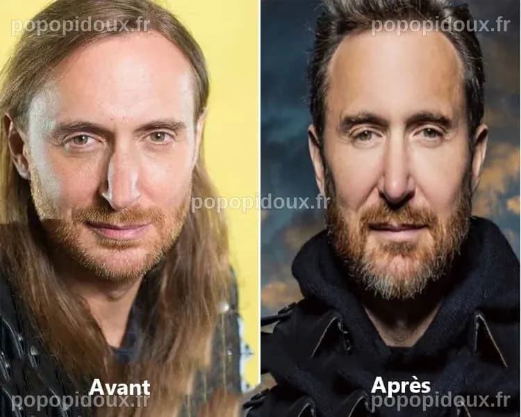David Guetta et la chirurgie esthétique : Une transformation qui fait parler