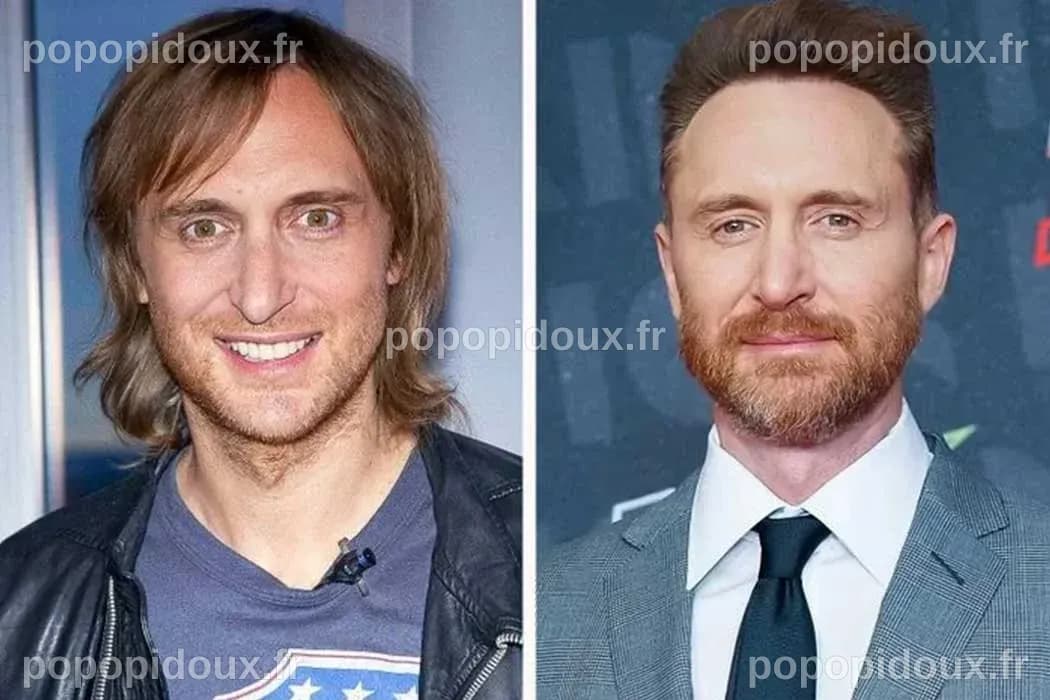 David Guetta chirurgie esthétique avant après