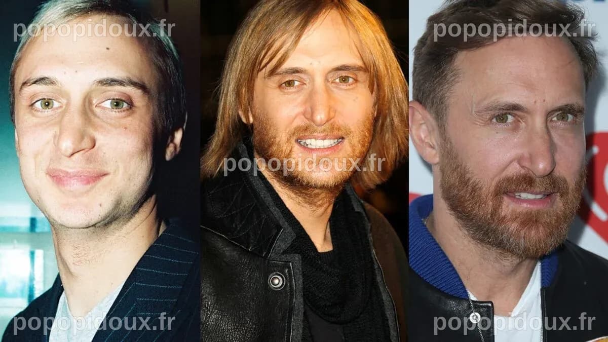 David Guetta chirurgie esthetique : Retour sur sa transformation physique