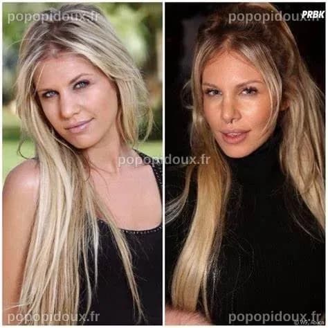 Adixia Avant Chirurgie : Transformation et Évolution d'une Célébrité de Téléréalité