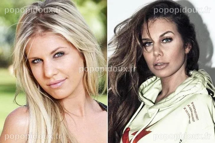 Adixia Avant AprÃ¨s Chirurgie