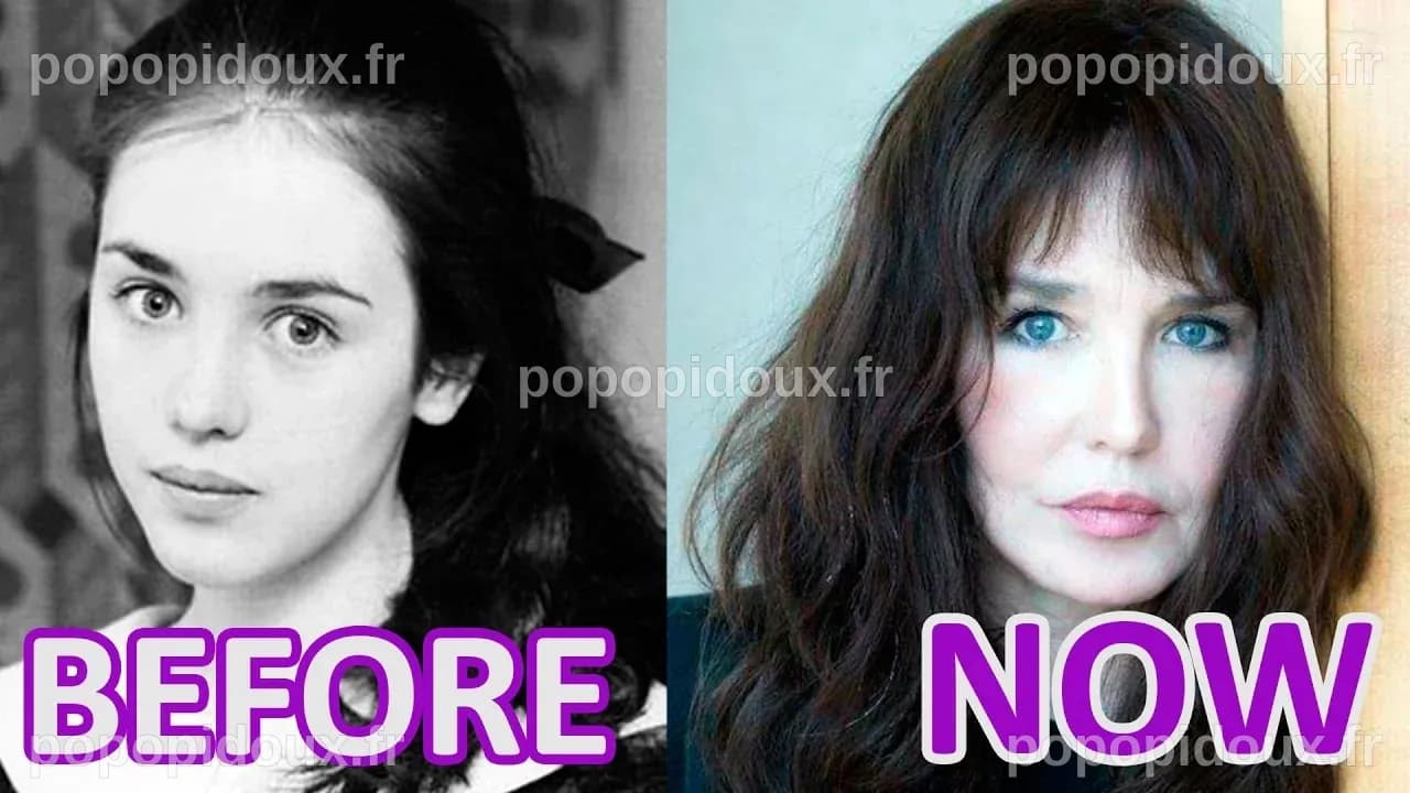L'impact de la chirurgie esthétique sur Isabelle Adjani : Une étude approfondie