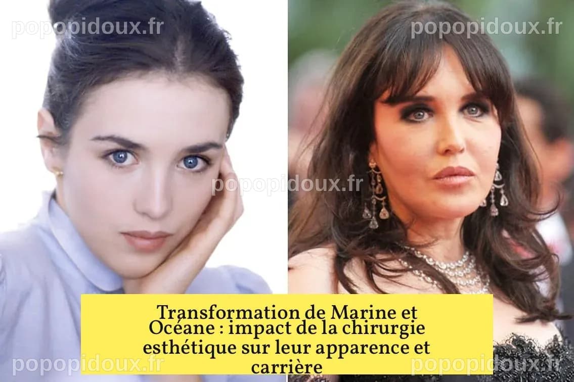 Transformation de Marine et Océane : impact de la chirurgie esthétique ...