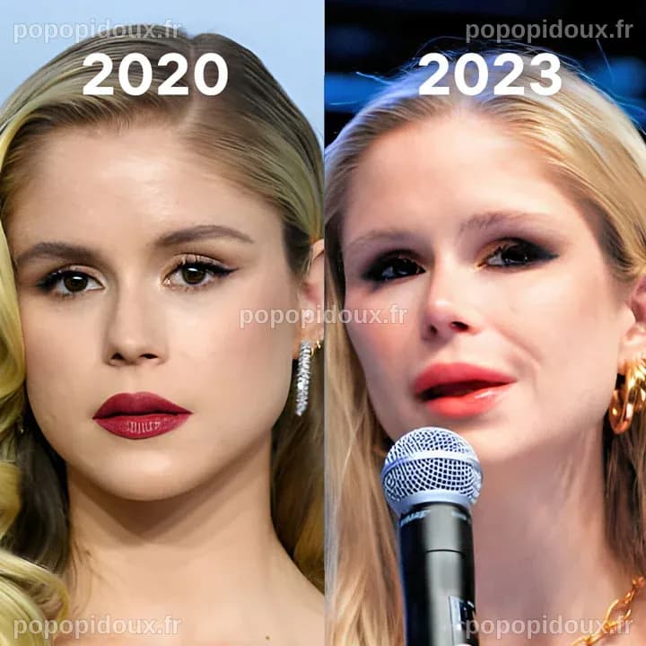 Erin Moriarty: chirurgie esthetique du nez ou pas?