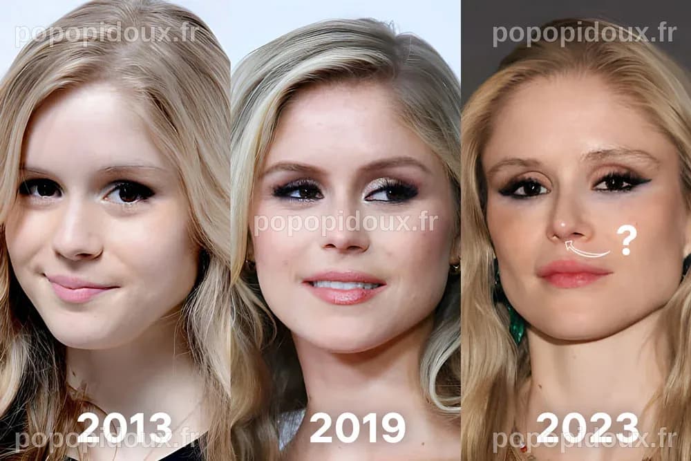 Erin Moriarty et la Chirurgie Esthétique : Vérités et Spéculations